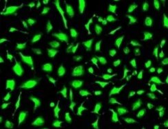 荧光修饰响应型造影脂质体定制技术(Fluorescently Labeled Stimuli-Responsive Imaging Liposome Customization Technology)