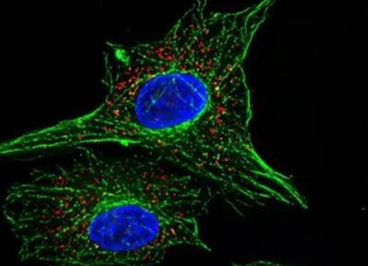 阳离子脂质体包载荧光标记siRNA技术(Cationic Liposome-Based siRNA Fluorescent Delivery Technology)